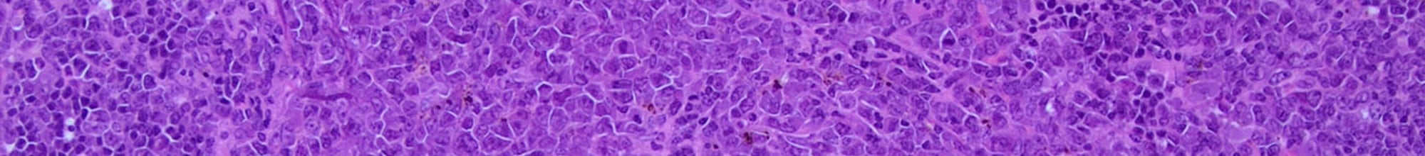 Immunology and Infectious-Disease